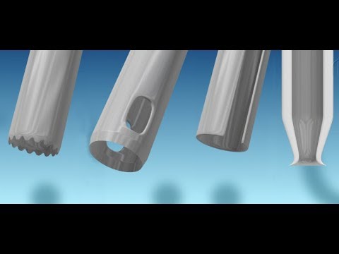 download lagu mp3 mp4 Fue Hair Transplant Tools, download lagu Fue Hair Transplant Tools gratis, unduh video klip Fue Hair Transplant Tools