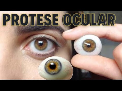 Olhos Artificiais: A Verdade Chocante por Trás das Próteses Oculares que Salvam Aparências e Vidas!