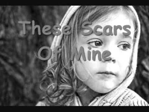 These Scars Of Mine Ch.3 Blue Eyes Part 1.wmv