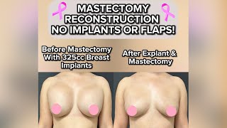Lampert Md Plastic Surgery