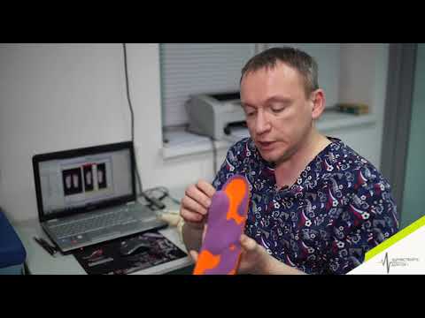 ортопедические стельки. Какие проблемы решают. Орфи