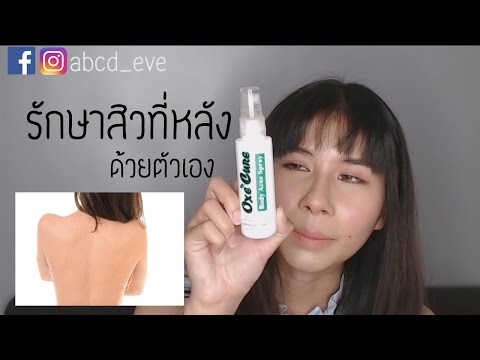 โรคสะเก็ดเงิน angioedema คู่มือโรคสะเก็ดเงิน Advantan