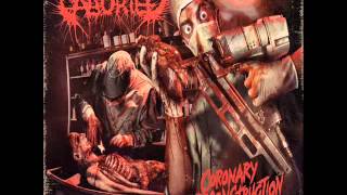 Download lagu Aborted - Coronary Reconstruction (Lyrics) mp3