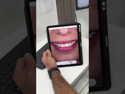 Smile Transformation Case Review with Dr Oscar