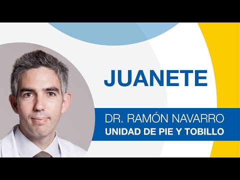 Juanete: Tratamiento y recuperación