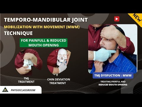 TMJ Mobilization With Movement Technique For Treating Painful And Reduced Mouth Opening