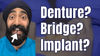 Replacement Options for Incisors - Denture vs Bridge vs Implant? - PS018