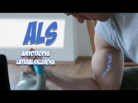 ALS - Amyotrophe Lateralsklerose | Krankheitslehre | Pflege Kanal