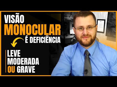 Is monocular vision a mild, moderate, or severe disability?