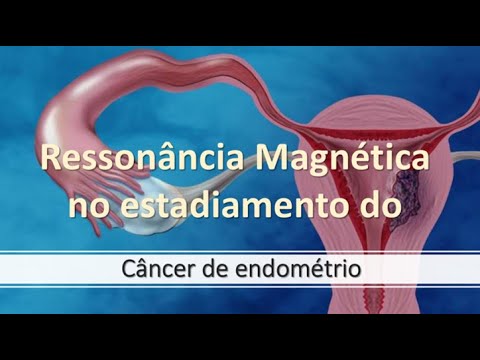 Ressonância Magnética - Estadiamento do câncer de endométrio.