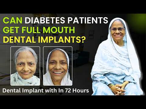Full mouth dental implants in a diabetic patient