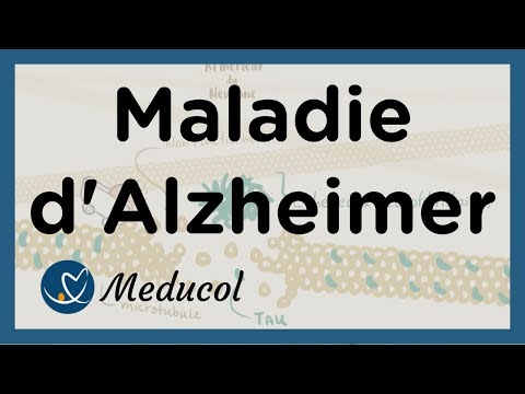 Alzheimer - Maladie Alzheimer : définition, symptômes, causes, stades, et traitement