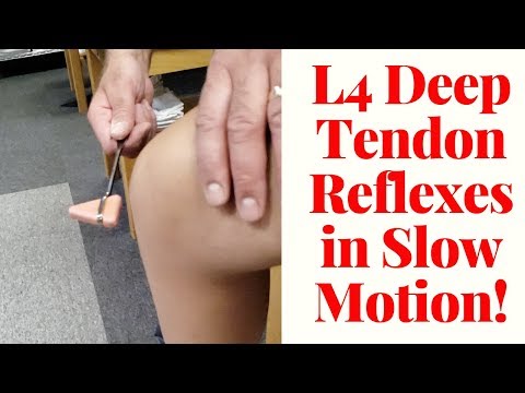 Hoffman s sign positive How to perform the test