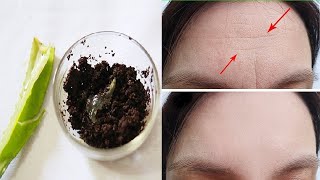 How to get rid of forehead wrinkles naturally