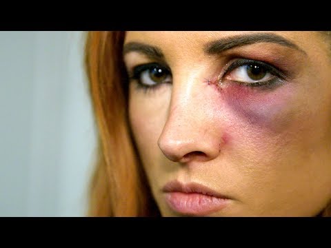 Becky Lynch Learns She Can’t Compete At Survivor Series: WWE Day Of