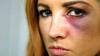 Becky Lynch learns she can't compete at Survivor Series: WWE Day Of