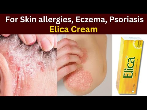 Elica cream how to use | Elica cream for eczema | medicine for skin allergy and itching