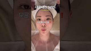 와.. 모공 흉터에 직빵인 시술 MTS 리뷰‼️#모공케어 #여드름관리 #여드름흉터