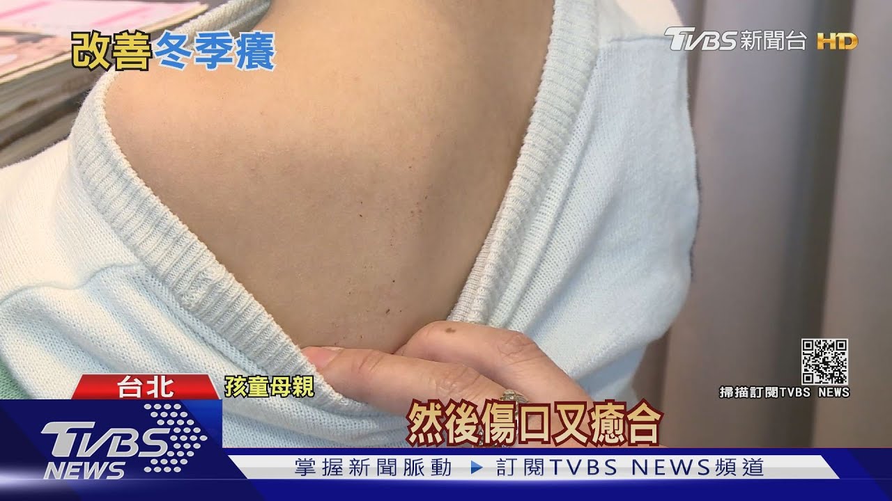 冬天癢「抓皮膚」!醫師警告別做這件事 否則治療很麻煩