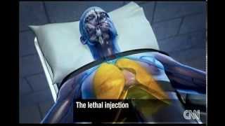 !!HOW LETHAL INJECTION WORKS!!