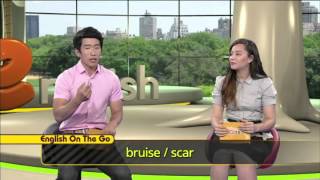 I got a big bruise on my leg.