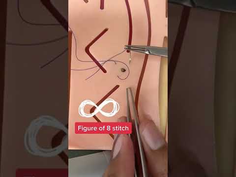 Figure of Eight stitch (8) || when to use it