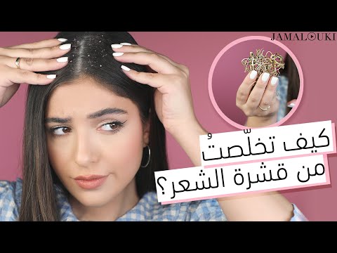 علاج قشرة الشعر من الاستعمال الأول | خلطة جدتي هنا hana
