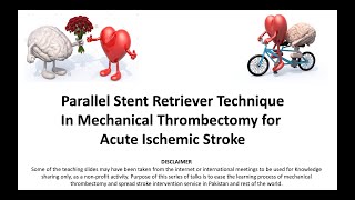 12. Parallel Stent Retriever Technique in Mechanical Thrombectomy for Acute Ischemic Stroke