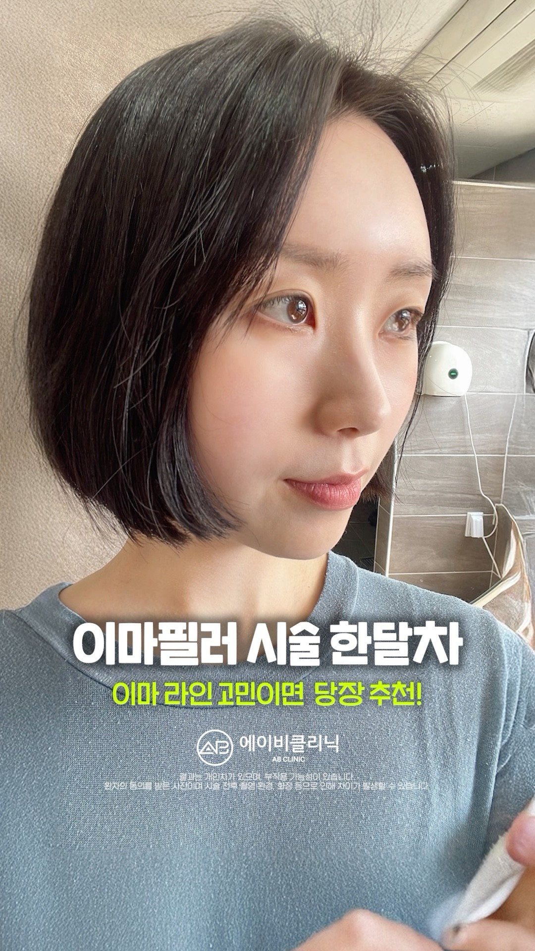 납작 이마 탈출기 🔥