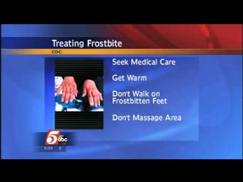 INTERVIEW: Frostbite and Hypothermia Danger