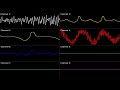 SNES F Zero Fire Field Oscilloscope View