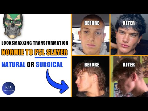 Greatest Looksmaxxing Transformation ? Normie To PSL Slayer (blackpill)