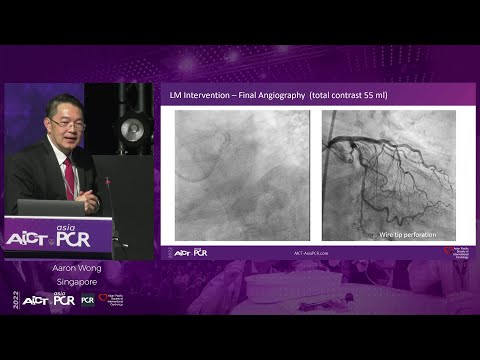 Evolving approaches to planning & guiding of complex PCI with ultra-low contrast - AICT-AsiaPCR 2022