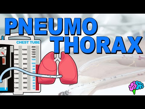 What is a Pneumothorax? EXPLAINED!