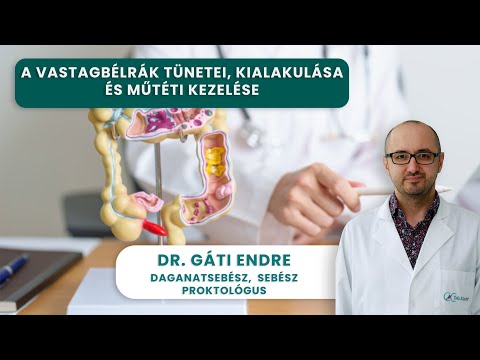 A VASTAGBÉLRÁK tünetei, kialakulása és műtéti kezelése | Dr. Gáti Endre