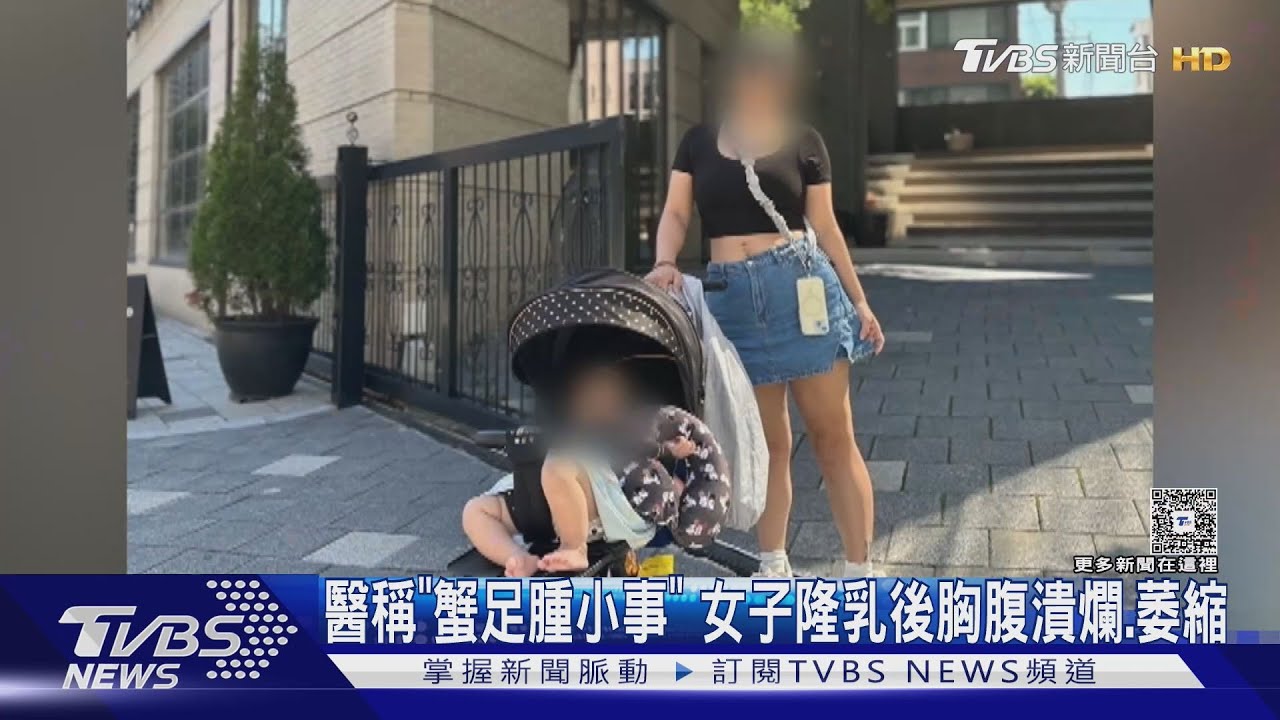 醫稱「蟹足腫小事」 女子隆乳後胸腹潰爛、萎縮　診所:不符事實
