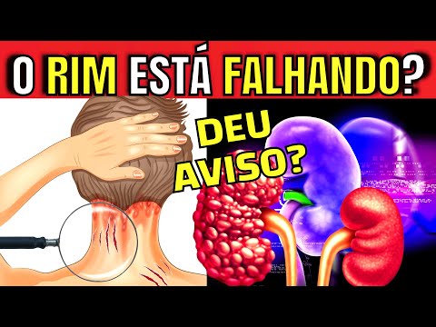 10 WARNING SIGNS that your KIDNEYS are FAILING (SYMPTOMS OF KIDNEY DISEASE MOST people don't know)