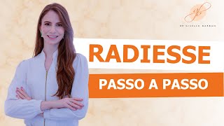 Radiesse: Passo a passo completa da aplicação - Dra Giselle Barban