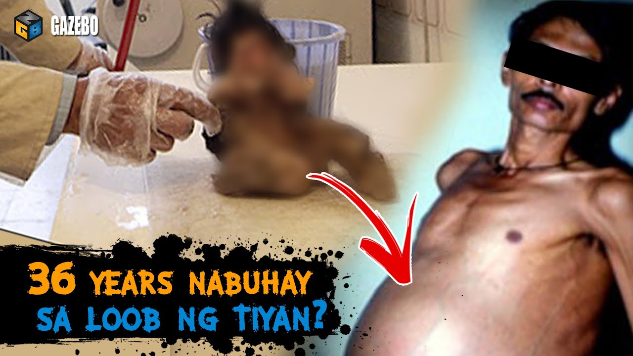 Putar video Hindi Akalain ng mga Doktor na Ito ang Makikita Nila sa Loob ng Tiyan ng Lalaking Ito sekarang Hindi Akalain ng mga Doktor na Ito ang Makikita Nila sa Loob ng Tiyan ng Lalaking Ito