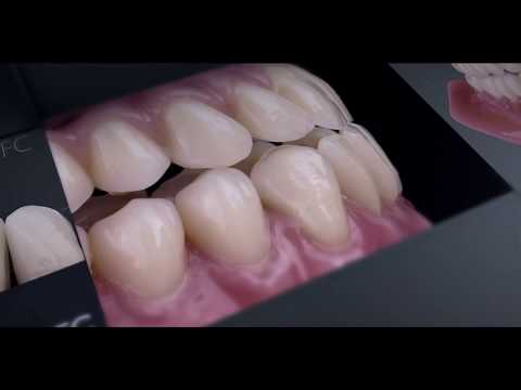 KZW 2017 Candulor Trailer