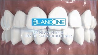 BlancOne erfindet die Zahnaufhellung neu (voiceover)