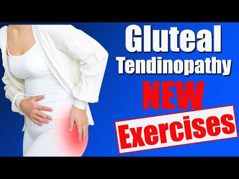 Gluteal Tendinopathy Exercises:12-Week Rehab Plan for Outer Hip Pain (Women 40+)