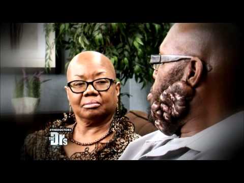 Man with Keloid Scars on his Face Searches for Treatment