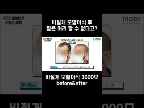 '모발이식 후 짧은 머리' 할 수 있다 vs 할 수 없다 #숏츠 #shorts