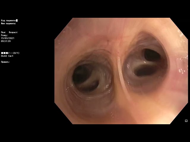 Анатомия бронхиального дерева.