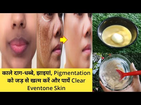 How to Remove Pigmentation from face|get rid of dark...