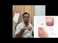 Q A Puting Payudara Masuk Ke Dalam