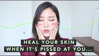🤢Sensitive Skincare Routine • How To Calm Down Irritated Skin