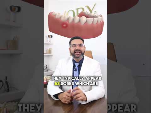 tired of Mouth ulcers. watch this #toothdoctor #dentalworld #dentalcare #business #oralhealth #
