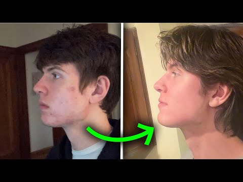 The ULTIMATE Guide To Getting A Perfect Jaw (Every Method)
